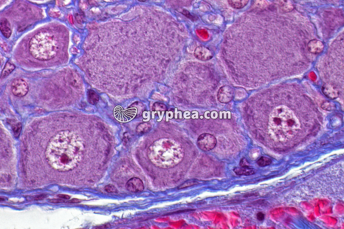 Ganglion rachidien CT x400 - gryphea.org